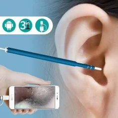 Caméra Endoscopique HD 720P pour Nettoyage d'Oreilles sur Smartphone